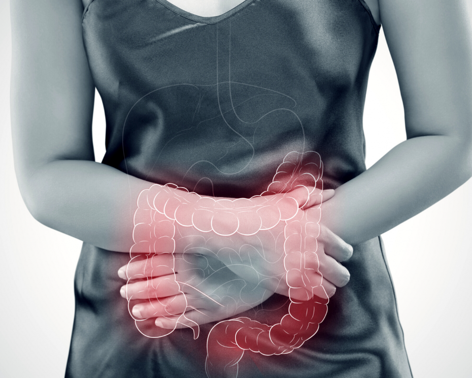 How to manage Microscopic Colitis - heike yates